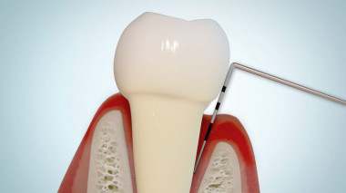 Modell eines Zahns